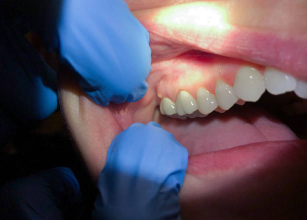 Best Orthodontic Emergency Dentist in Elma Center, NY