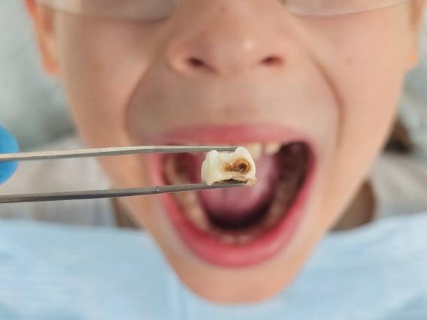 Best Pediatric Emergency Dentist in Elma Center, NY